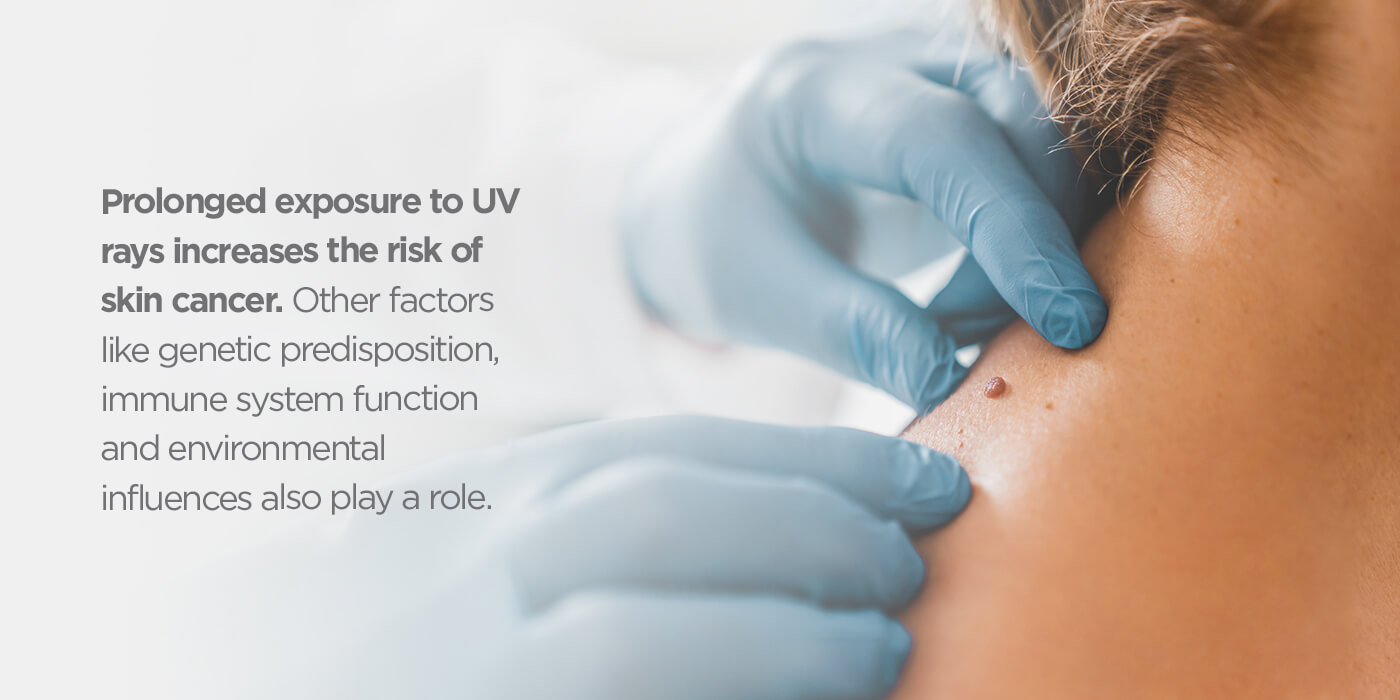 UV辐射如何连接皮肤癌